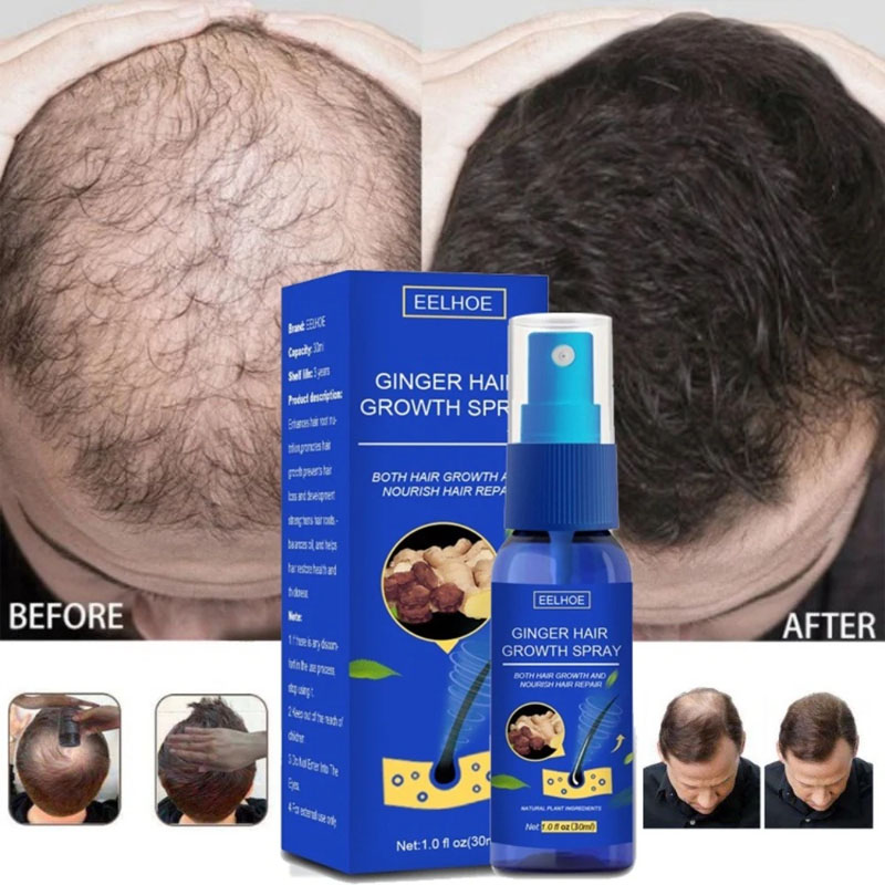 Hair Care Essence Oil Spray - Suero para el crecimiento del cabello