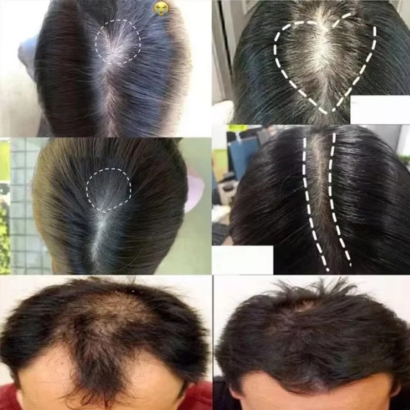 Suero para el crecimiento del  - Hair Care Essence Oil Spray reseña y precio