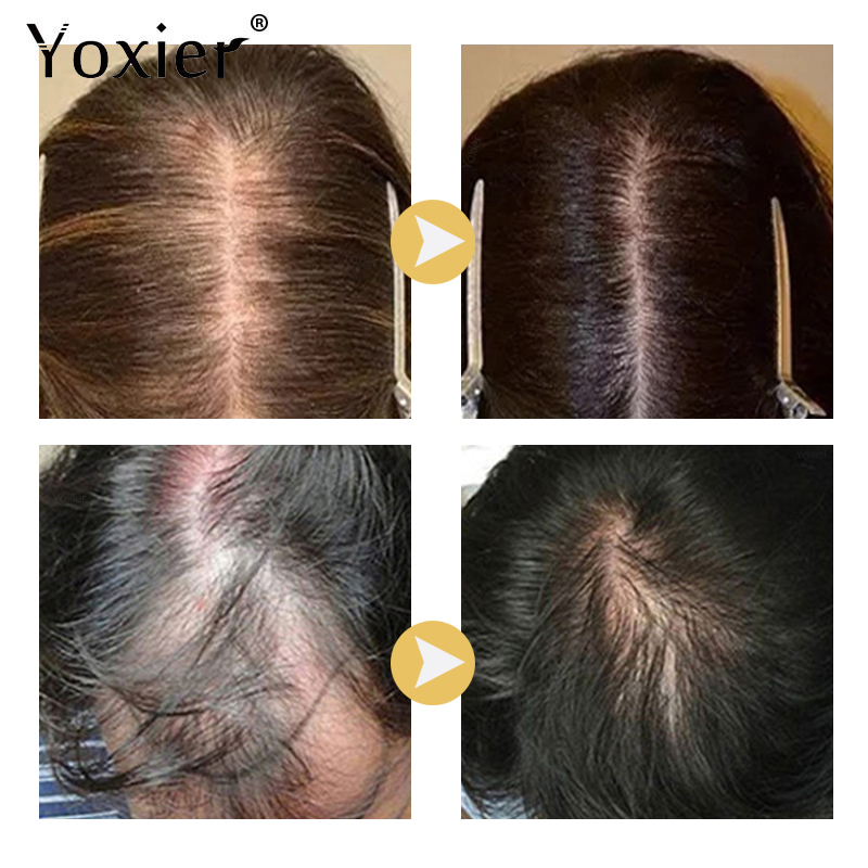 Suero de crecimiento intensivo - Hair Care Growth reseña y precio