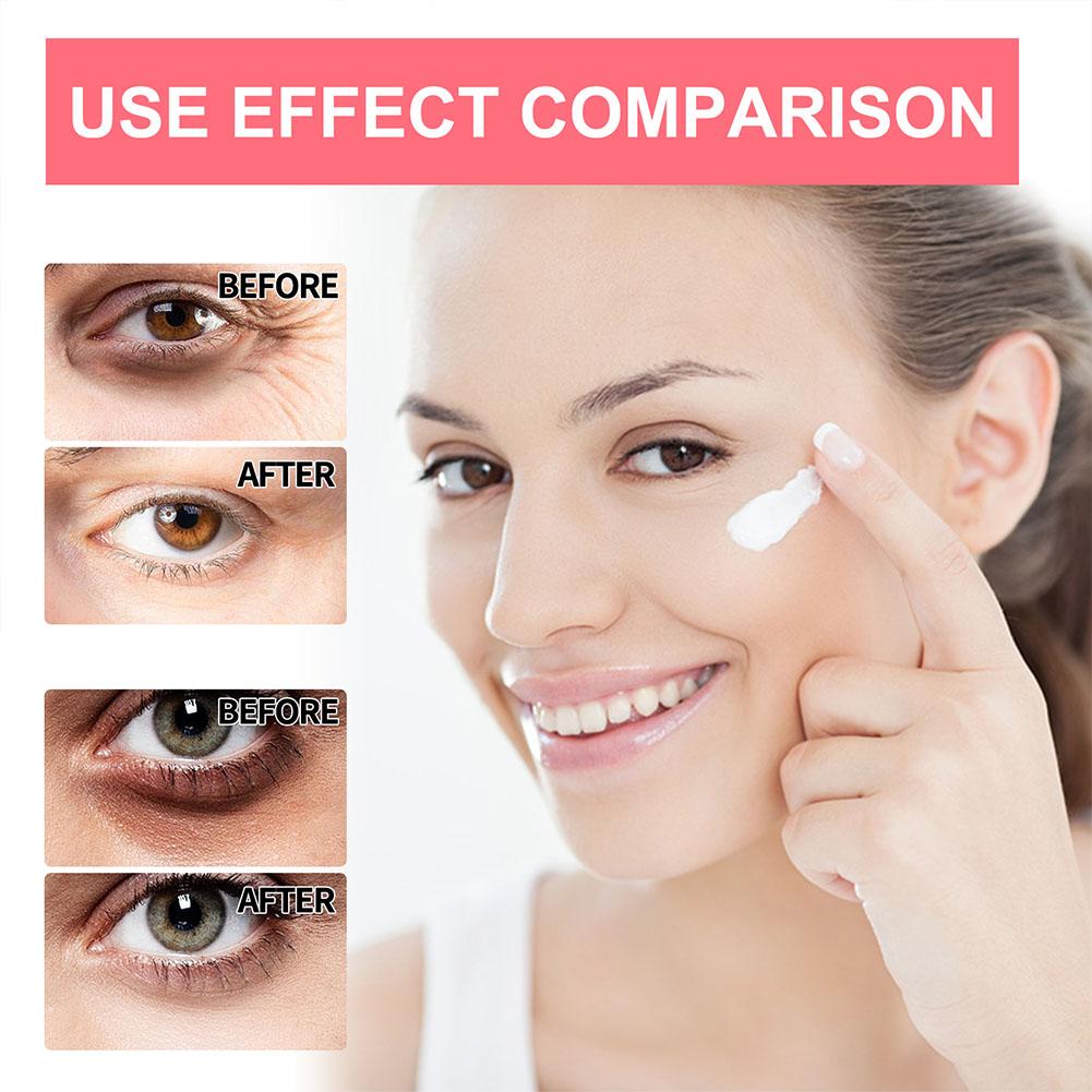 Crema de ojos con retinol, acl - The Ordinary Serum Hyaluronic Acid reseña y precio