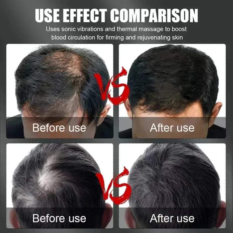 Gorro de Terapia Capilar con L - Hair Care Growth reseña y precio